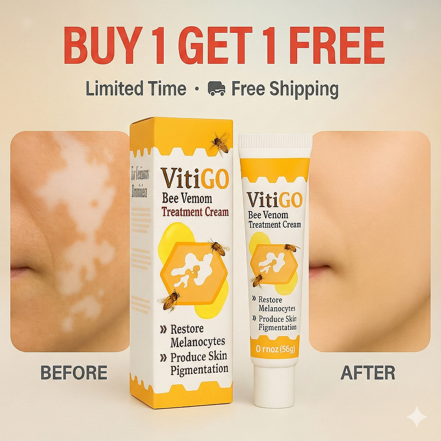 VitiGO™ - Vitiligo தீர்வு (⚡Buy 1 Get 1 FREE⚡)