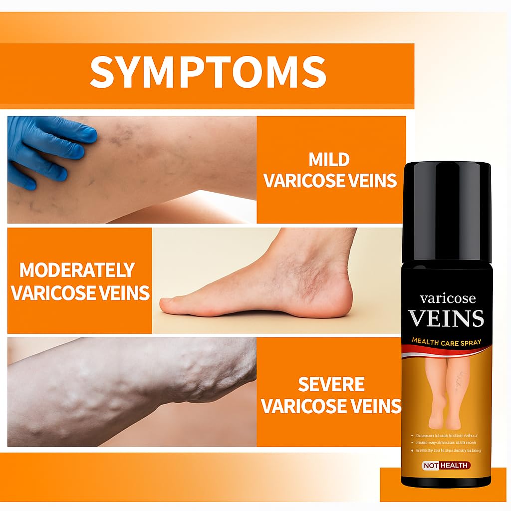Turmeric Varicose Veins Relief Spray (நரம்பு சுருட்டல் நிவாரணி)