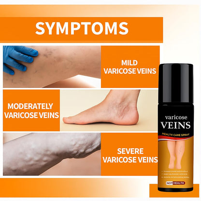 Turmeric Varicose Veins Relief Spray (நரம்பு சுருட்டல் நிவாரணி)