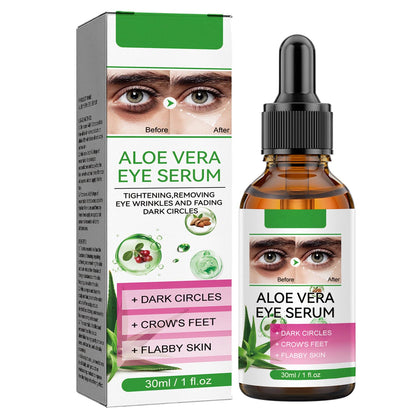 Aloe Vera Eye Serum (30ml) – ✨ Fades Eye Dark Circles, Wrinkles & Fine Line