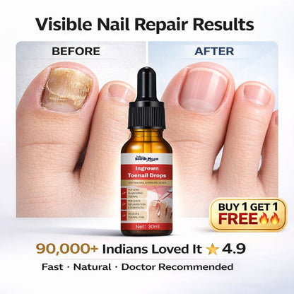 Toenail Drops Repair Oil (1+1 FREE🔥) - நகம் சரியாகும்!