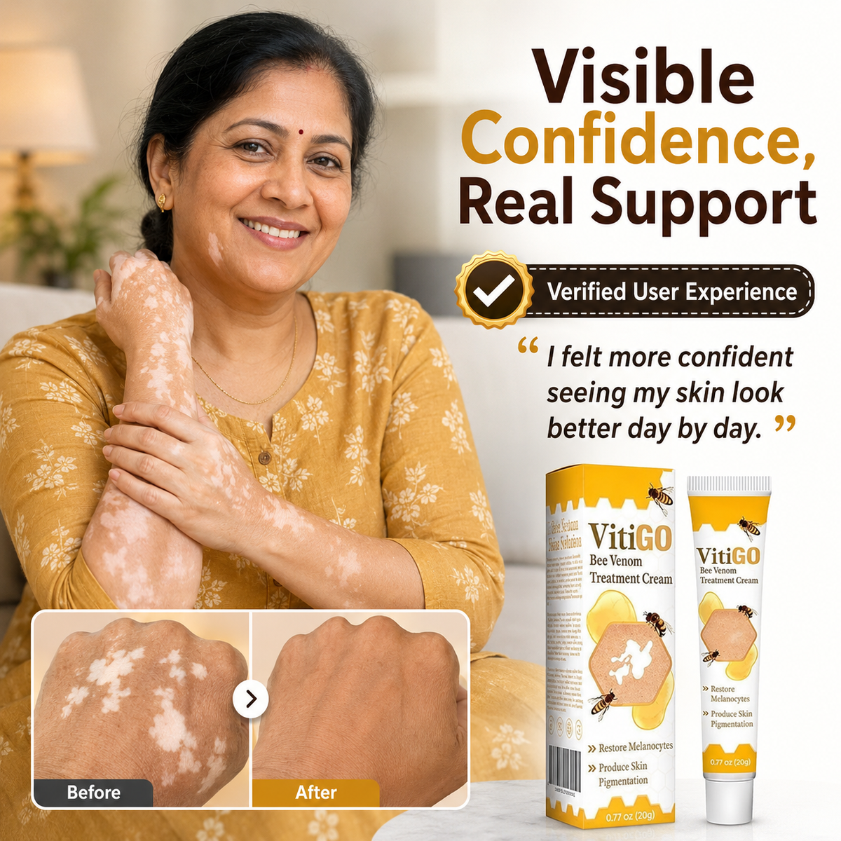 VitiGO Corrector Lotion - BUY 1 GET 1 FREE 🔥