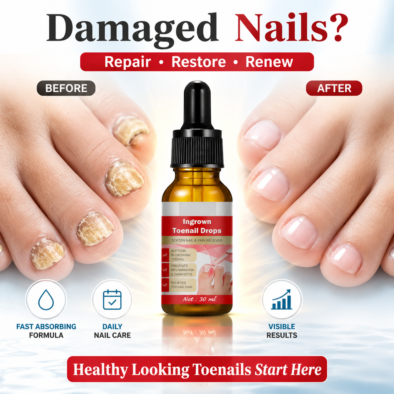 Toenail Nail Repair Oil (Buy 1 Get 1 FREE🔥)