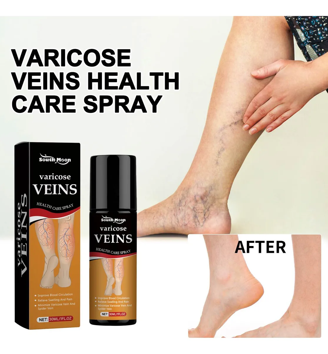 Varicose Veins Relief Spray - (Buy 1 Get 1 FREE🔥🔥)