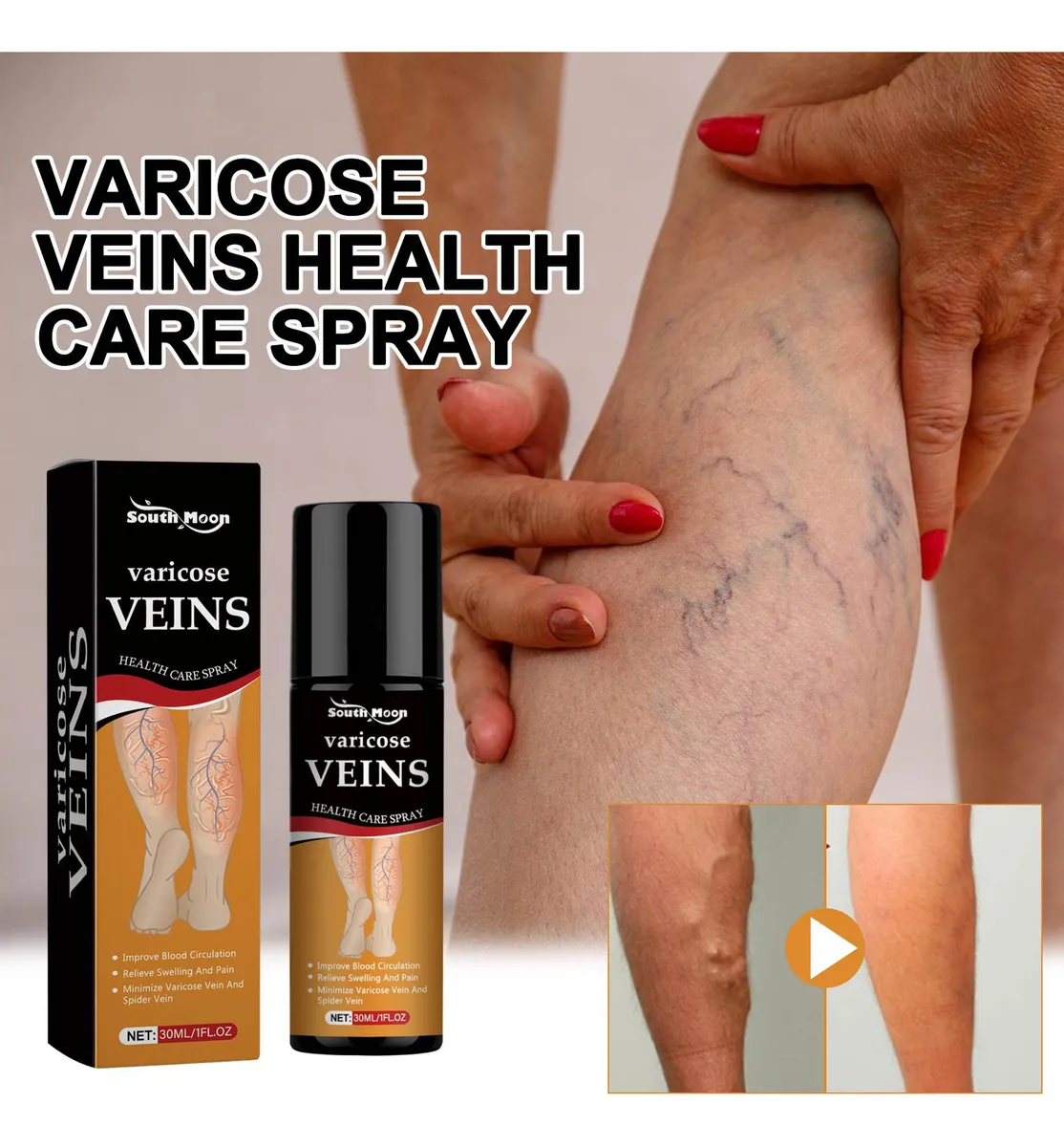 Varicose Veins Relief Spray - (Buy 1 Get 1 FREE🔥🔥)