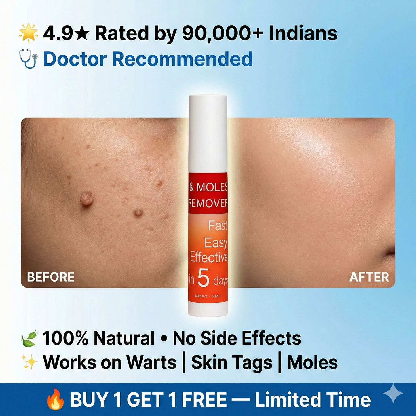 Warts & Tags Remover Roll On
