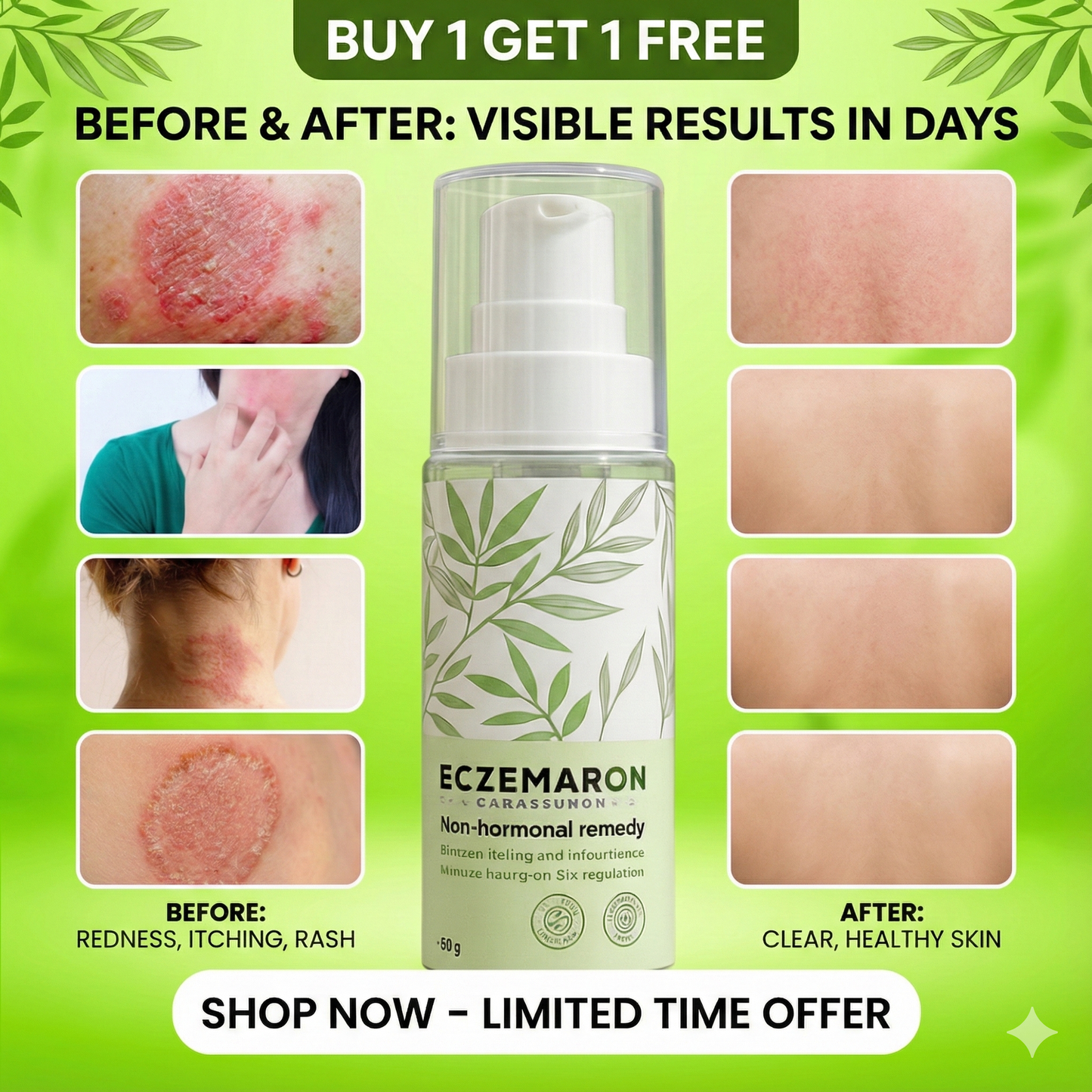 Eczemaron Anti-Fungal & Itch Relief Spray | 100% Safe | Buy 1 Get 1 FREE 🔥🔥