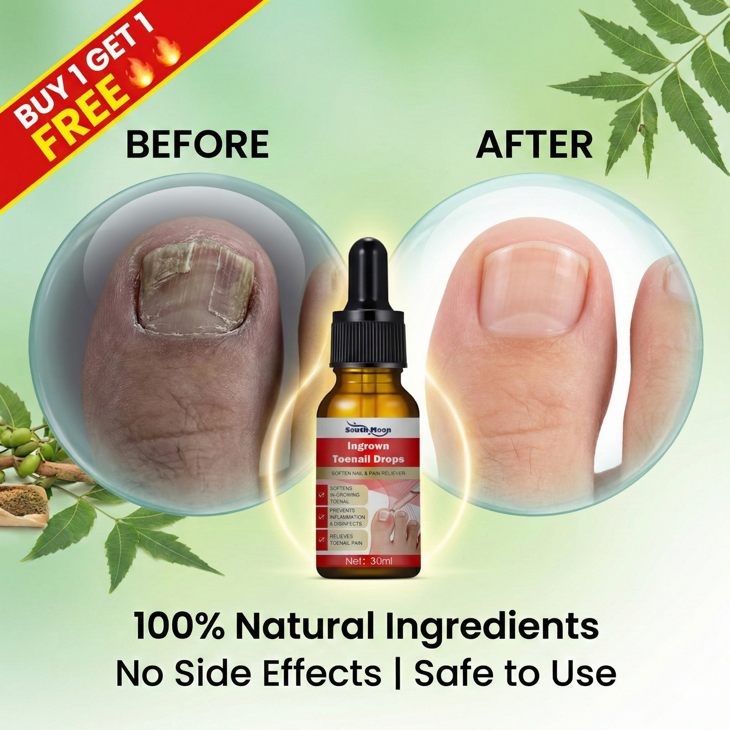 Toenail Drops Repair Oil (1+1 FREE🔥) - நகம் சரியாகும்!