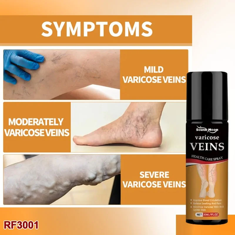 Varicose Veins Relief Spray - (Buy 1 Get 1 FREE🔥🔥)