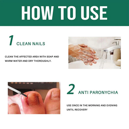 Anti Paronychia Herbal Relief Oil 🌿-(🔥 BUY 1 GET 1 FREE )