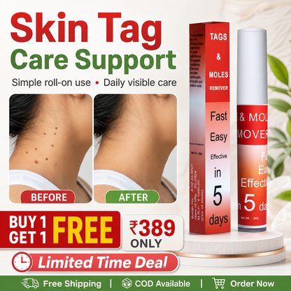 Warts & Tags Remover Roll On