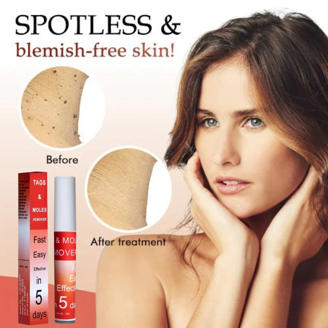 LOVILDS™ Warts & Tags Remover (Buy 1 Get 1 FREE🔥🔥)