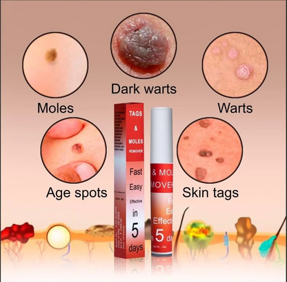 Warts & Tags Remover Roll On